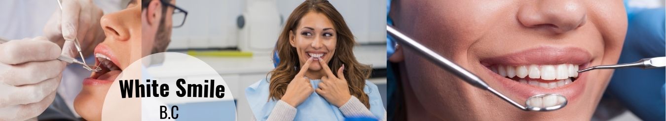 Save up to 63% Off - Professional Blue-LED Teeth Whitening at White Smile B.C in Nanaimo & Victoria