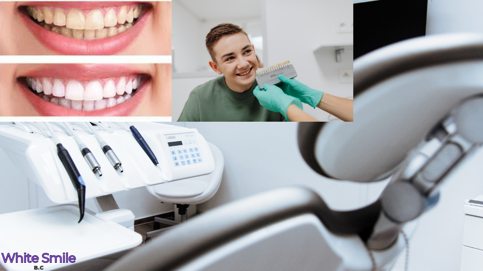 1 Blue-LED Teeth-Whitening Treatment